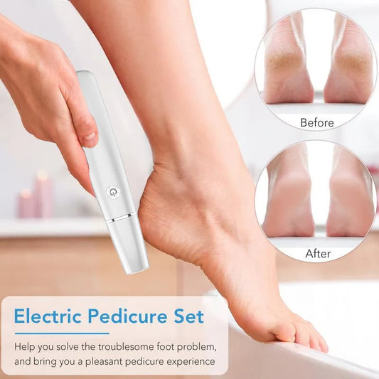 🌟Hot Sale 49% OFF❤️Electric Feet Callus Remover