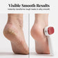 ✨📢LAST DAY SALE: Only ￡12.99!!!🔥Double-Sided Foot Scraper for Callus Removal